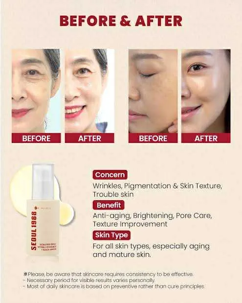 KSECRET%20SEOUL%201988%20Serum%20Retinal%20Liposome%202%25%20+%20Black%20Ginseng%2030ml%20-%20K%20secret%20seoul%20Retinal%20Face%20Serum%20-%20Image%205