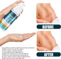 Advanced Scar Gel For Acne Scars Stretch Mark Removal Cream Advanced Scar Treatment 50ml,Natural Scar Therapeuti Gel,Advanced Skin Renewal Gel,Scar Removal Cream for Old Scars (1 Pcs). 