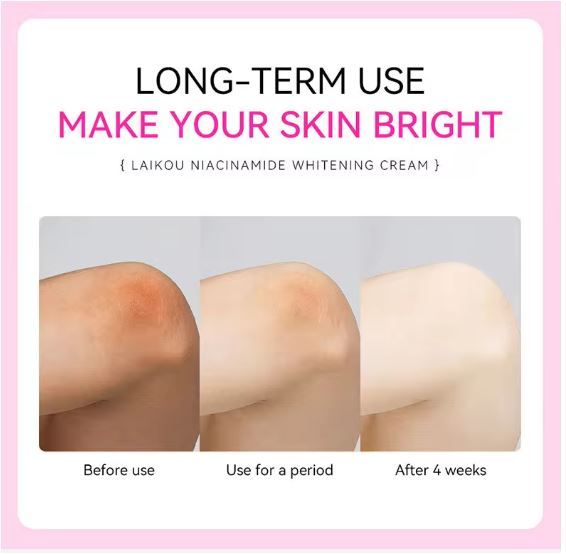 LAIKOU%20Niacinamide%20Whitening%20Lighten%20Spots,%20Moisture%20Cream-%20100g%20-%20Image%206