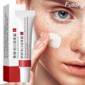 Face Chloasma Removal Cream For Women Remove Melasma Brighten Cream Facial Fade Dull Brightening Cream Dark Skin Lightening Care.
