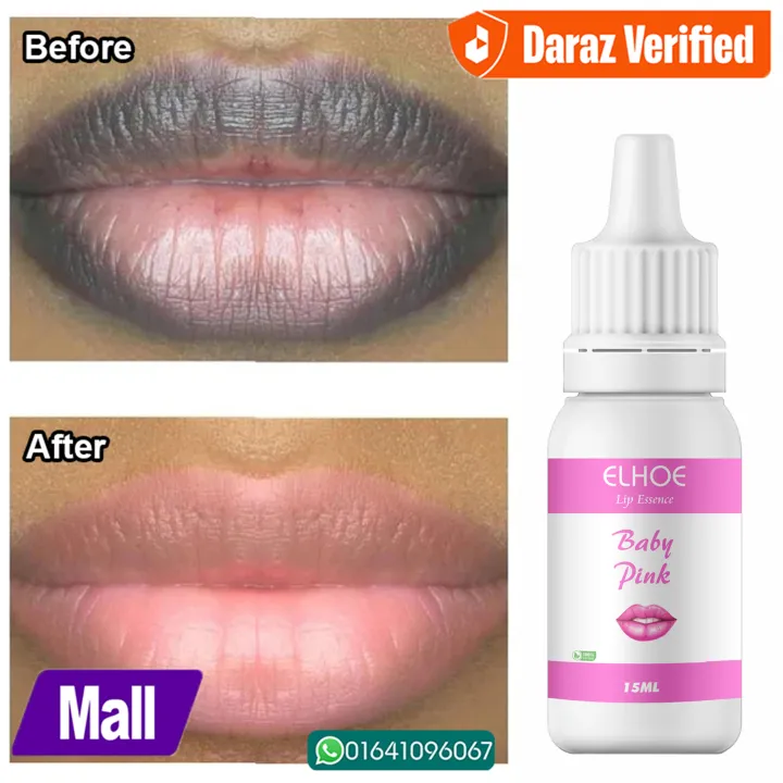 ELHOE%20Baby%20Pink%20Drop:%20Best%20Lip,%20Nipple%20&%20Skin%20Whitening%20Serum.%20Get%20a%20Natural%20Rosy%20Pink%20Glow%20for%20Lips%20&%20Nipples.%20Buy%20Now%20-%20Image%202