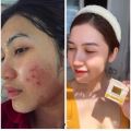 KT Gold Plus Night Cream – Intensive Whitening & Anti-Aging Formula (10g) – Made in Thailand. 