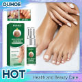 Nail Fungal Treatment Serum Anti Infection Toe Fungus Repair Liquid Cuticle Paronychia Onychomycosis Hand Foot Nail Care Essence. 