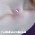 Microdermal Medusa Titanium Dermal Crystal Top Piercing Surface 1.6mm 14G 3 4 5 7mm Choose Jewel Color 1Pc. 