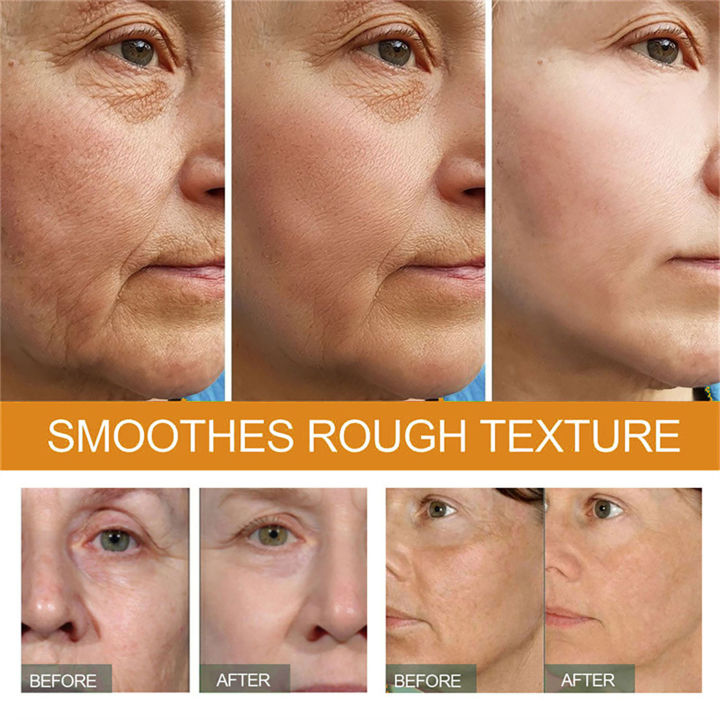 White%20Rice%20Whitening%20Face%20Cream%20Remove%20Dark%20Spots%20Anti-Wrinkle%20Fade%20Fine%20Lines%20Anti%20Aging%20Moisturizing%20Brighten%20Korean%20Cosmetics%20-%20Image%203