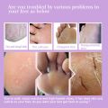 【The Edge of Beauty】2pcs Exfoliating Foot Pedicure Socks Feet Mask Remove Dead. 