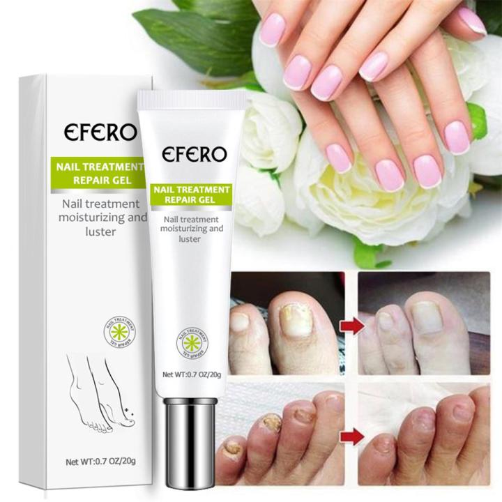 Efero Nail Cream Treatment Repair Gel and Luster -20gm