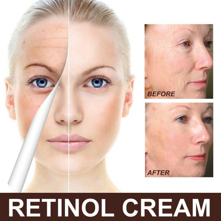 New%2030g%20kin%20Cream%20Retinol%20Anti-Aging%20Moiturizer%20Nourihing%20Moiturizing%20Cream%20-%20Image%203