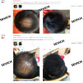 Sevich Hair Fibers Regrowth Powder Keratin Hair Building Fiber Powder Instant Hair Growth Concealer Applicator Hair Loss Product Lateil.