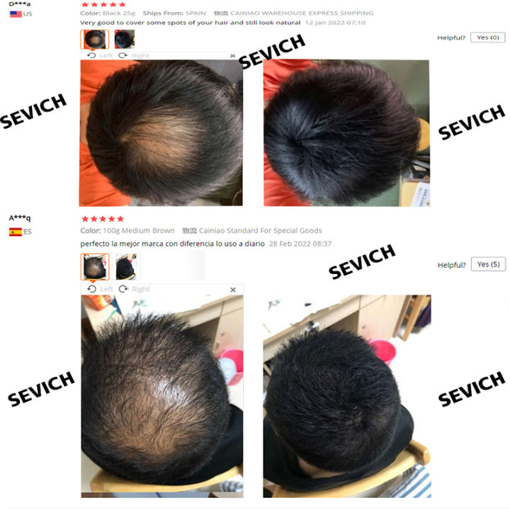Sevich%20Hair%20Fibers%20Regrowth%20Powder%20Keratin%20Hair%20Building%20Fiber%20Powder%20Instant%20Hair%20Growth%20Concealer%20Applicator%20Hair%20Loss%20Product%20Lateil%20-%20Image%205