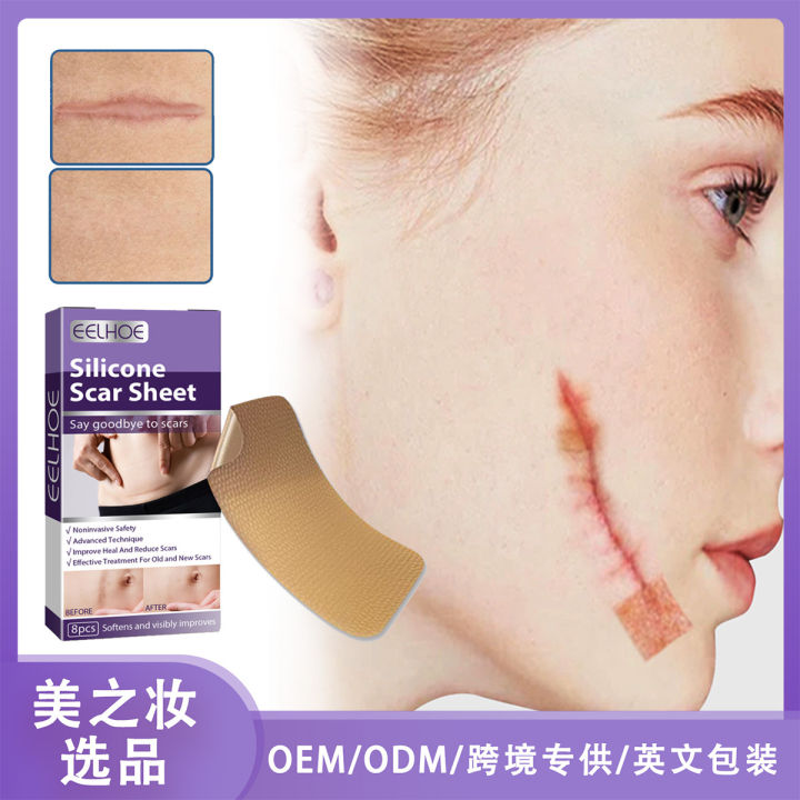 Eelhoe Silicone Scar Patch Fade Pregnancy Cesarean Surgery Scar Hyperplasia Silicone Repair Mask
