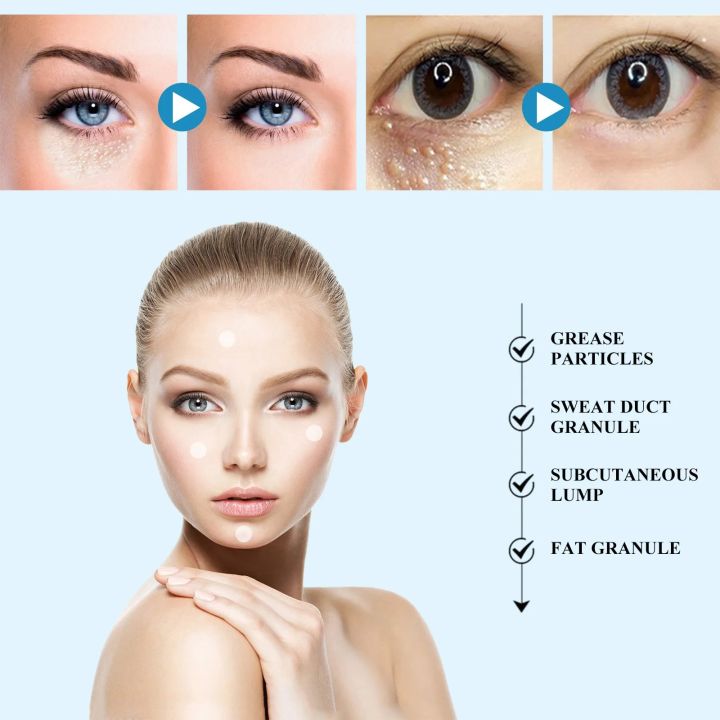 New%20144patch/Box%20Milia%20Remover%20Eye%20Cream%20Nourishing%20Moisturizing%20Repair%20Smoothing%20Eye%20Patches%20Eyes%20Pad%20-%20Image%205