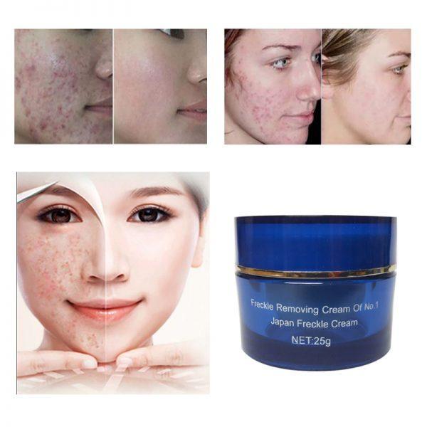 International%20Japan%20product%20Skin%20care%20Anti-freckle%20cream%20used%20for%20male/female%20-%2025%20gm%20-%20Image%202