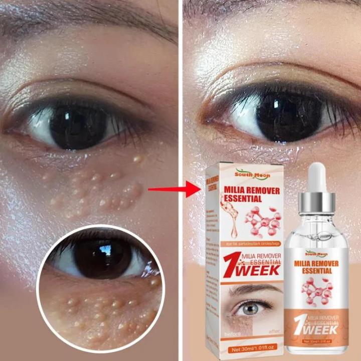 Fat Granules Removal Eye Serum Eye Milia Repair Treatment Products Wrinkle Lifting Moisturizing Anti-Puffiness Korean Skin Care