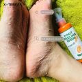 Foot Peeling Spray Whiten Foot Natural Orange Essence Pedicure Hands Dead Skin Exfoliator Exfoliating Care Tool Japan Cosmetics. 