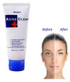 Mis Tine Acne Clear Oil Control Facial Foam Face Wash 85g. 