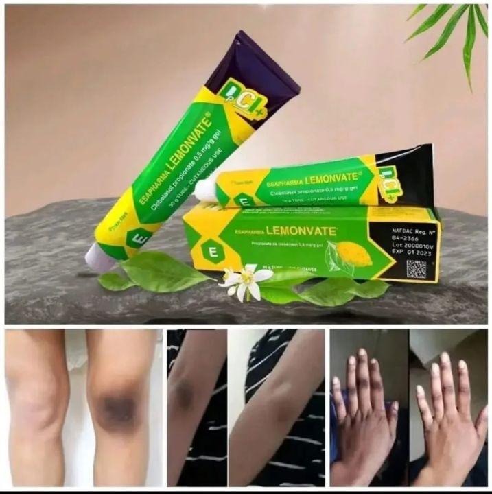 Lemonvate%20Cream%2030%20G%20-%20Image%202