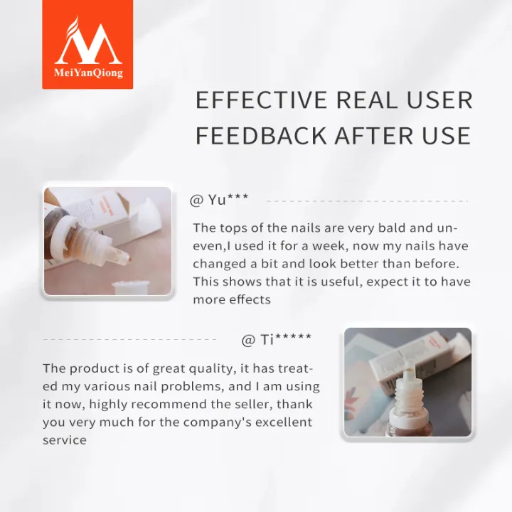 MeiYanQiong%20Lavender%20Fungal%20Nail%20Treatment%20Essential%20Oil%20Nail%20Art%20&%20Tools%20Promote%20Nails%20Grow%20Healthy%20Nail%20Treatment%20Onychomycosis%20Foot%20Care%20-%20Image%207