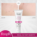RtopR Face Exfoliating gel Moisturizer Repair Facial Scrub Cleaner Acne Blackhead Treatment Face Cream skin care. 