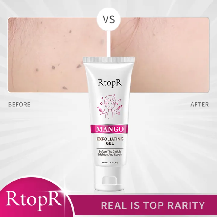RtopR%20Face%20Exfoliating%20gel%20Moisturizer%20Repair%20Facial%20Scrub%20Cleaner%20Acne%20Blackhead%20Treatment%20Face%20Cream%20skin%20care%20-%20Image%205