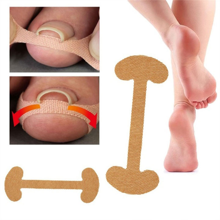 20pcs%20Professional%20Embedded%20Toe%20Nail%20Corrector%20Sticker%20Toenail%20Care%20Pedicure%20Thumb%20Curl%20Correction%20Sticker%20-%20Image%202