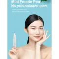 Mini Freckle Removal Pen Portable Skin Mole Dark Spot Face Wart Tag Tattoo Removal Device Skin Care Tool. 