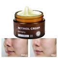 Retinol Face Cream+Facial Serum+Eye Cream Set Anti-Aging Remove Wrinkle Eye Bag Whitening Moisturizing Skin Lightening Cream. 