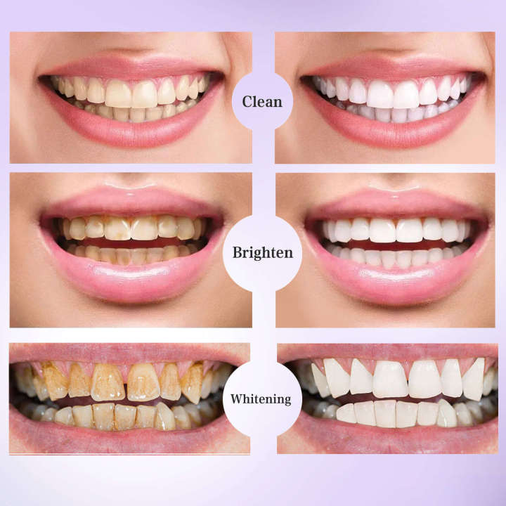 New%20v34%20purple%20toothpaste,%20tooth%20color%20correction,%20smoke%20stain%20removal,%20and%20bright%20white%20toothpaste%20-%20Image%203