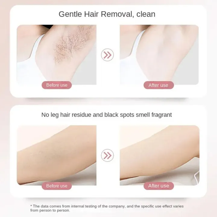 Intimate/Private%20Hair%20Removal%20Cream%20For%20Unwanted%20Hair%20In%20Underarms,%20Private%20Parts,Area,%20Painless%20Depilatory%20Cream%20-%20Image%205