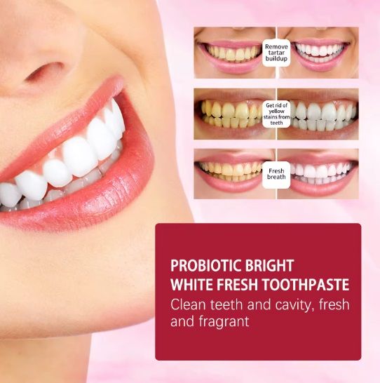 SP%204%20UltraBrightening%20Toothpaste,%20Advanced%20Whitening%20Formula%20for%20Stain%20Removal%20and%20Enamel%20Protection%7C%20Fresh%20Mint%20Flavor%7C%20SP4,%20SP6,%20S10%20%20Toothpaste%20-%20Image%204