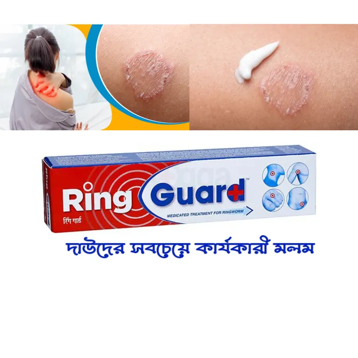Ring Guard Anti Fungal Medicated Cream 12g | Indian