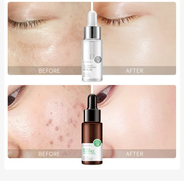 LAIKOU%20Sakura%20Serum%20Japan%20Extract%20Serum%20Niacinamide%20Essence-%2017%20ml%20-%20Image%203