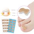Pexmen 10/20/Ingrown Toenail Correction Stickers Toenail Corrector Patch Big Toe Nail Corrector Patch.