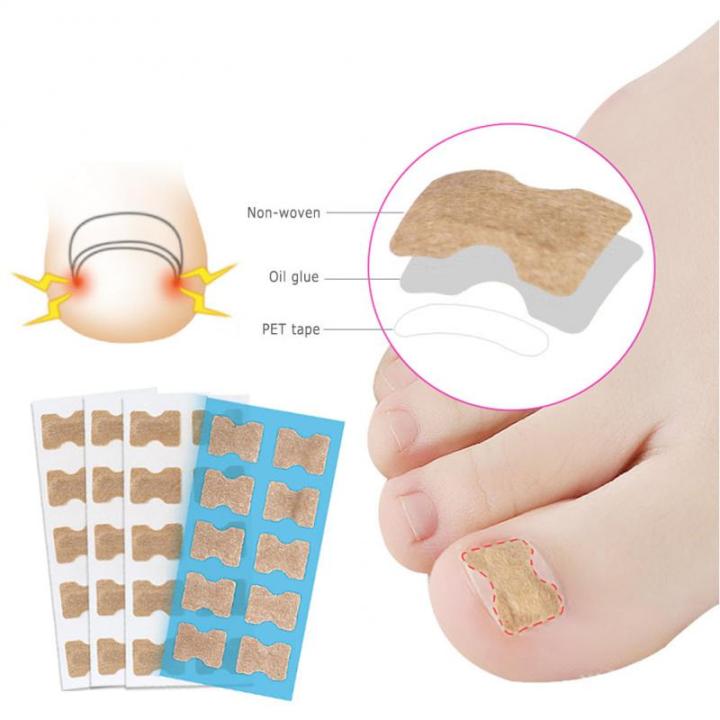 Pexmen 10/20/Ingrown Toenail Correction Stickers Toenail Corrector Patch Big Toe Nail Corrector Patch