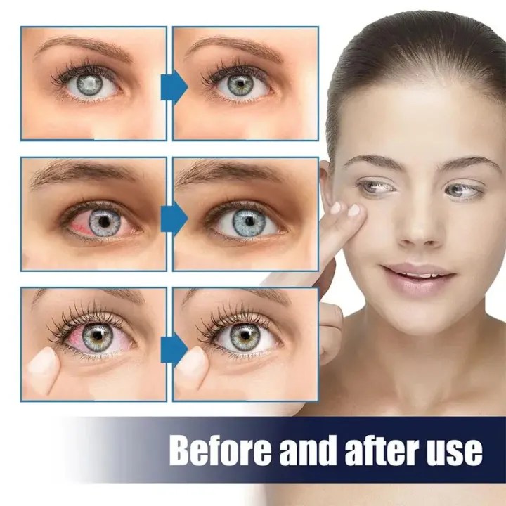 13ml%20Cooling%20Eye%20Drops%20Lubricating%20Eye%20Drops%20For%20Dry%20Eyes%20Eyedrops%20Redness%20Relief%20Nursing%20Eye%20Fatigue%20O5p8%20-%20Image%203