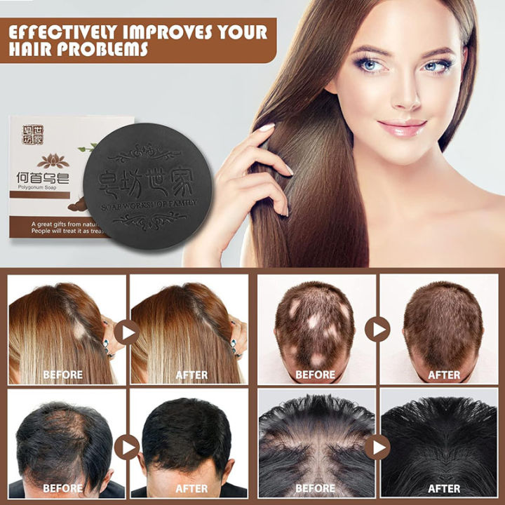 Polygonum%20Multiflorum%20Anti-mite%20Oil%20Control%20Hair%20Soap%20Deep%20Cleaning%20White%20Hair%20Turns%20Black%20Thicker%20Dandruff%20Removal%20Repair%20Moisturize%20Damaged%20Hair%20Handmade%20Soap%20-%20Image%205
