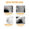 Papaya Peeling Gel clean keratin Facial skin removal melanin Whitening Repair brighten body care exfoliating Moisturizing Cream.
