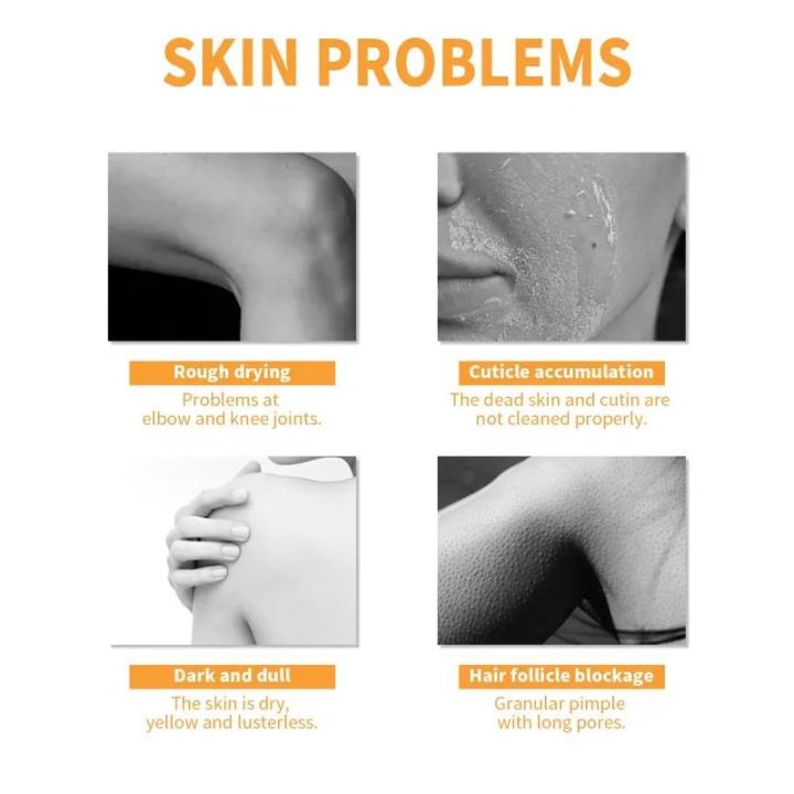 Papaya%20Peeling%20Gel%20clean%20keratin%20Facial%20skin%20removal%20melanin%20Whitening%20Repair%20brighten%20body%20care%20exfoliating%20Moisturizing%20Cream%20-%20Image%203