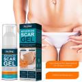 50ml Scar Removal Gel - Effective Stretch Mark, Acnes Spots, Burns and Surgical Scars Treatment Cream - Retinol, Allantoin,Vitamin E - Post Surgery Skin Repair Supplies No Side Effects. 
