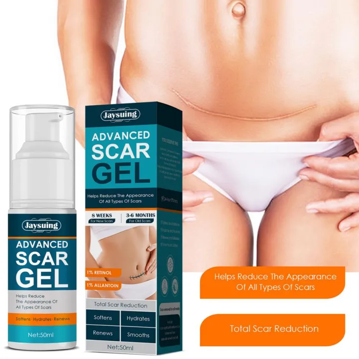 50ml%20Scar%20Removal%20Gel%20-%20Effective%20Stretch%20Mark,%20Acnes%20Spots,%20Burns%20and%20Surgical%20Scars%20Treatment%20Cream%20-%20Retinol,%20Allantoin,Vitamin%20E%20-%20Post%20Surgery%20Skin%20Repair%20Supplies%20No%20Side%20Effects%20-%20Image%205