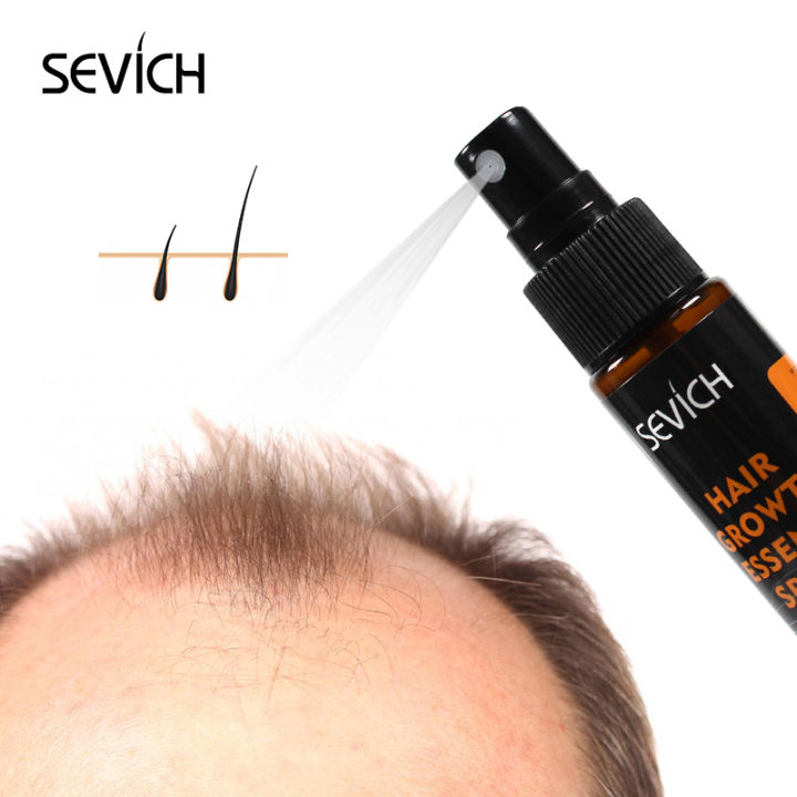 SEVICH%20Hair%20Growth%20Essence%20Spray%20Hair%20Care-30ml%20-%20Image%203