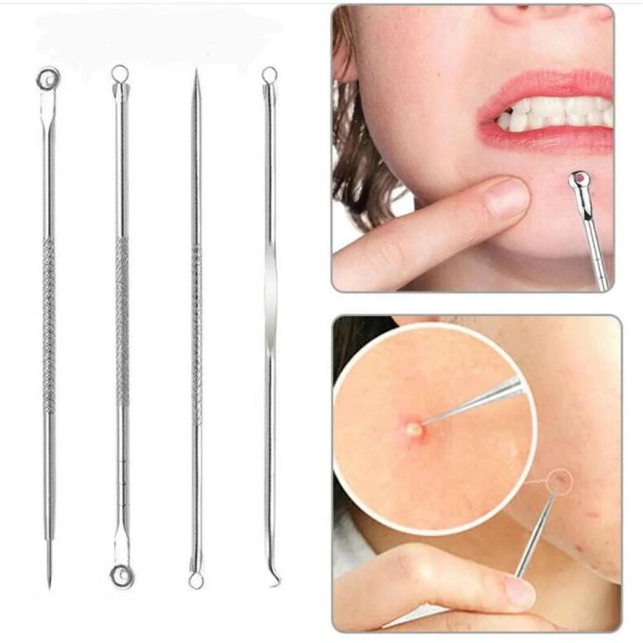 4Pc/Set Stainless Steel Blackhead Removal Kit Acne Blemish Pimple ...