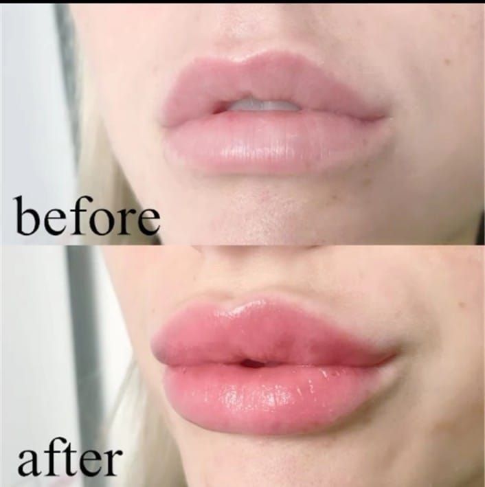 Lnanigi%20lip%20sleeping%20mask%203%20gm.%20-%20Image%204