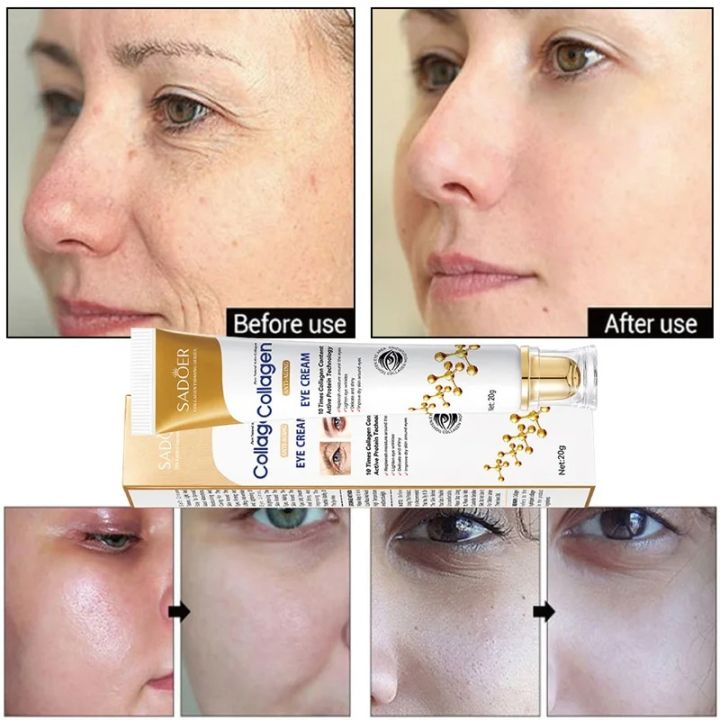 SADOER%20Collagen%20Anti-Aging%20Eye%20Cream-%2020g%20-%20Image%202