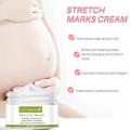 Pregnancy Stretch Mark Repair Cream Stretch Scar Marks Remover Maternity Obesity Treatment Body Postpartum Smooth Skin Care. 