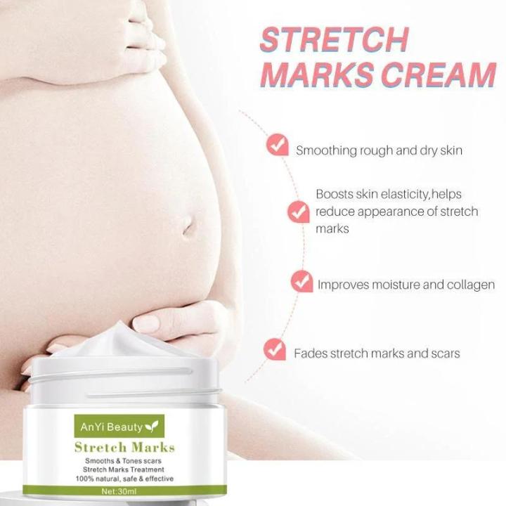 Pregnancy%20Stretch%20Mark%20Repair%20Cream%20Stretch%20Scar%20Marks%20Remover%20Maternity%20Obesity%20Treatment%20Body%20Postpartum%20Smooth%20Skin%20Care%20-%20Image%205