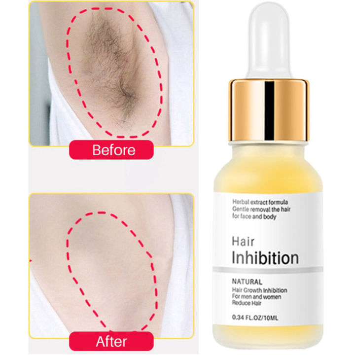 Permanent%20Hair%20inhibition%20Serum%20Hair%20Removal%20Serum%20Armpit%20Legs%20Arms%20Hair%20Growth%20Inhibitor%20Body%20Cream%20Mild%20Hair%20Nourishing%20Lotion%20-%20Image%202