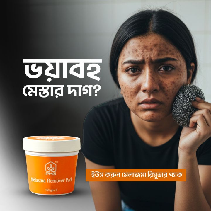 Melasma Remover Cream