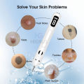 (NEW) Face Mole Removal Pen Spots Tattoo Freckle Removal Pen Skin Tag Remover LED Lighting Sweep Mole Removing Dark Spot Remover Skin Care 9 Adjustable Modes Laser Mole Pen. 