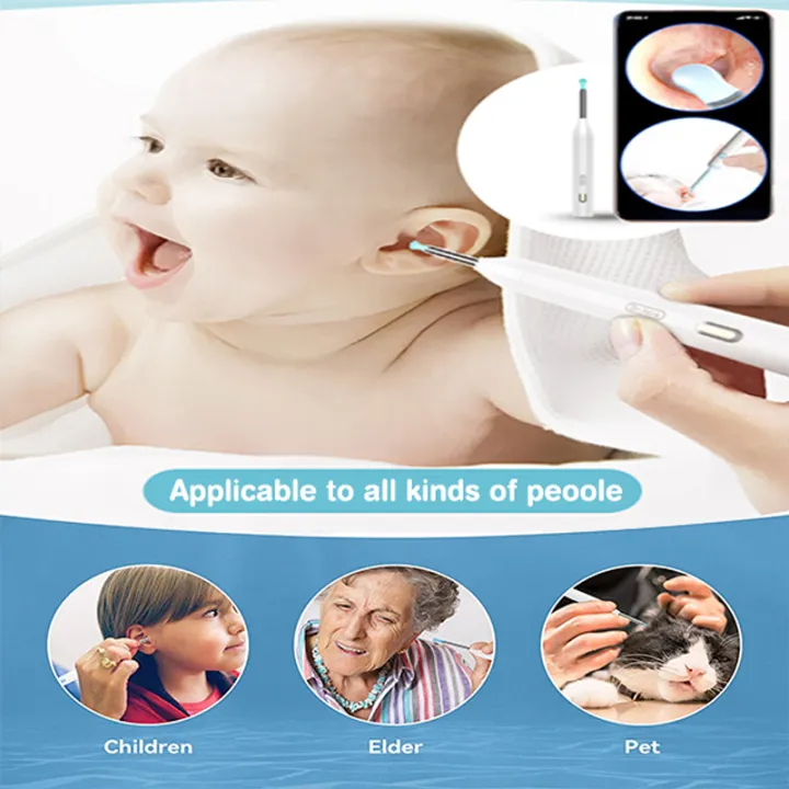 Dr.Isla%20Wireless%20WiFi%20Ear%20Pick%20Otoscope%20Camera%20Borescope%20Luminous%20Ear%20Wax%20Cleaning%20Teeth%20Oral%20Inspection%20Health%20Care%20Ear%20Cleaner%20-%20Image%203